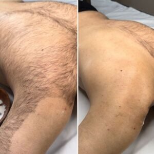 Depilação com Cera Marroquina