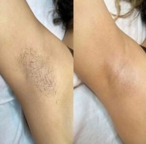 Depilação com Cera Marroquina